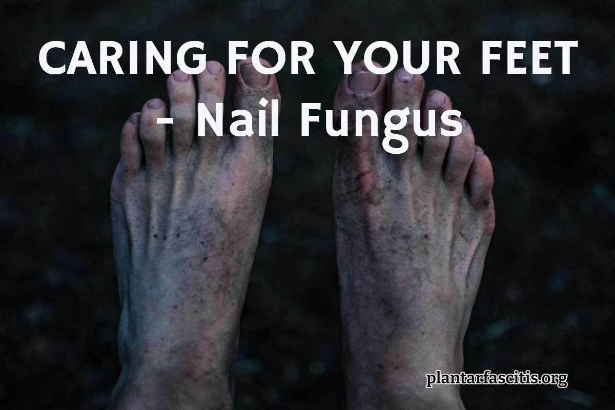 CARING FOR YOUR FEET - Nail Fungus