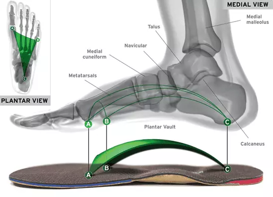 Custom Orthotics