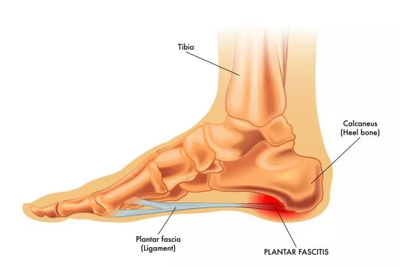 Plantar Fasciitis Stretches in Bed