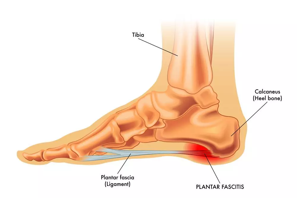 Plantar Fasciitis Stretches in Bed