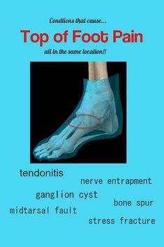 Top of Foot Pain Causes